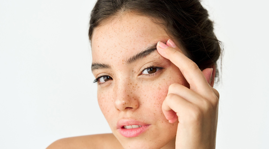 Brow lift